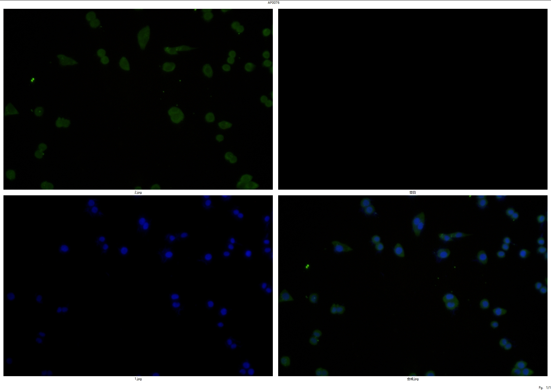 Rabbit polyclonal antibody to NFKB~p65