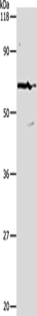 PKM
