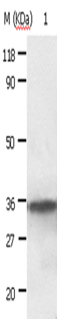 ANXA2