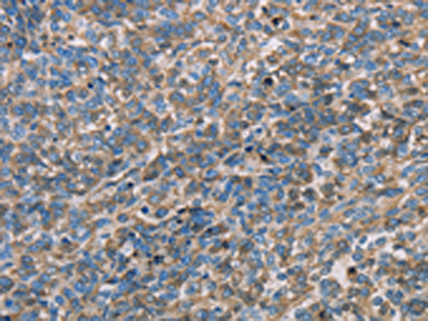 APOA1