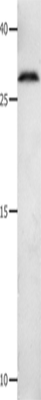 MMP7