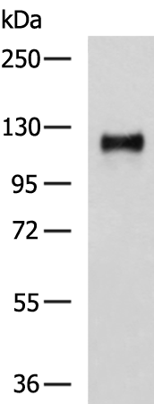 NFKB1