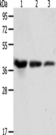 ANXA1
