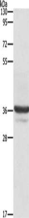 ANXA3