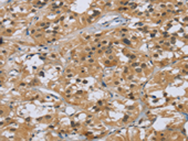 Rabbit Polyclonal Antibody to KRT5