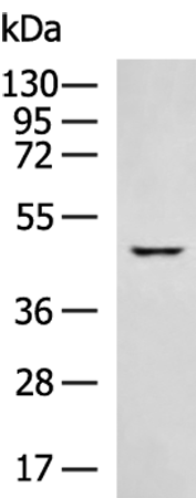KRT23