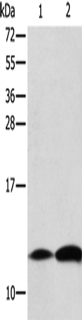 B2M