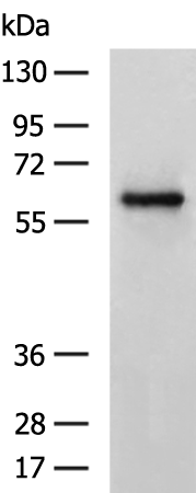 CBX2