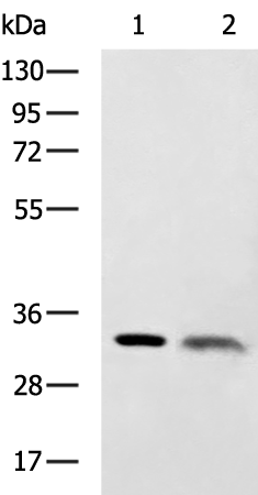 CDK5