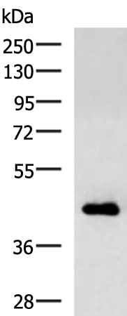 CHI3L1