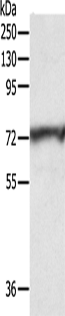 CNNM3