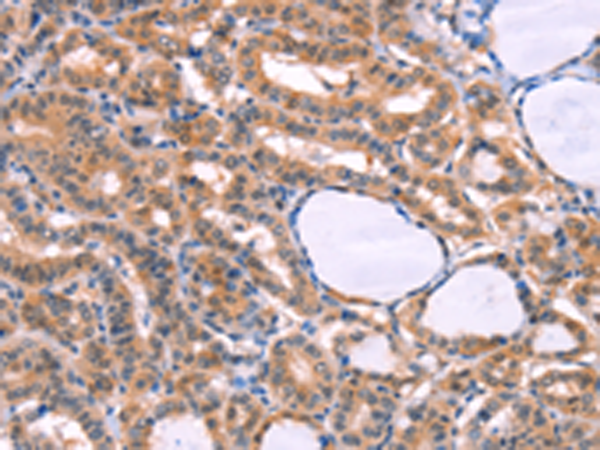 CYP1B1