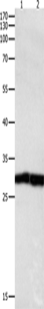 DUSP6
