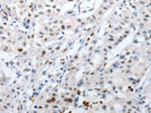 HSPA1A