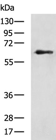 IGF2BP2