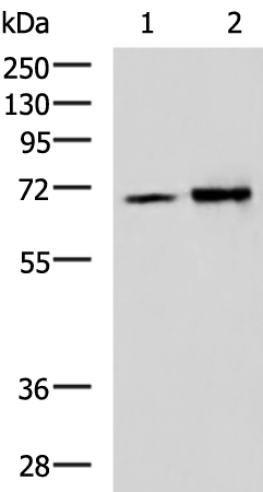 IGF2BP3
