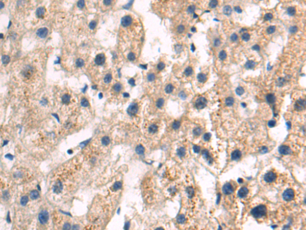 ITGA4