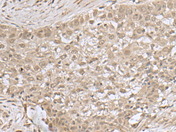 NEUROG3