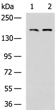 PDGFRB