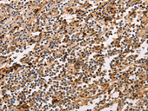 Rabbit Polyclonal Antibody to PPP1CB