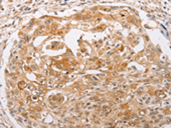 Rabbit Polyclonal Antibody to PPP1CB