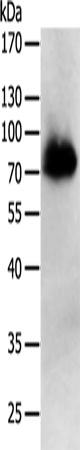 PRMT7