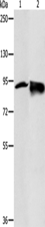 RRM1