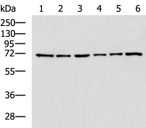 SPDL1
