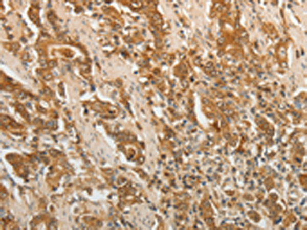 Rabbit Polyclonal Antibody to F3
