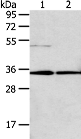 TNFAIP1