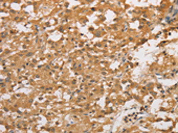 Rabbit Polyclonal Antibody to ARHGEF5