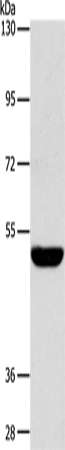 SPTLC1