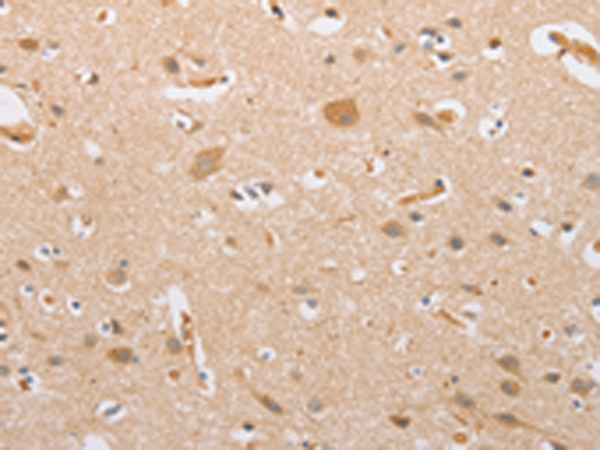 CSGALNACT2