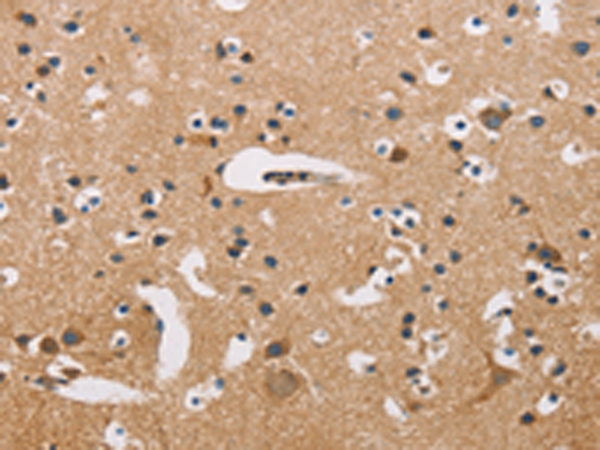ATP2C1