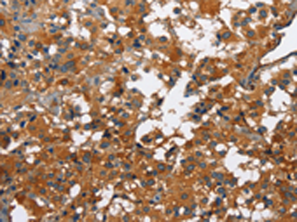 Rabbit Polyclonal Antibody to CATSPER3