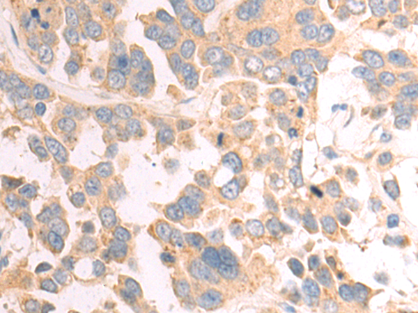 Rabbit Polyclonal Antibody to KLRB1