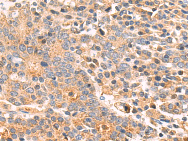 Rabbit Polyclonal Antibody to KLRB1