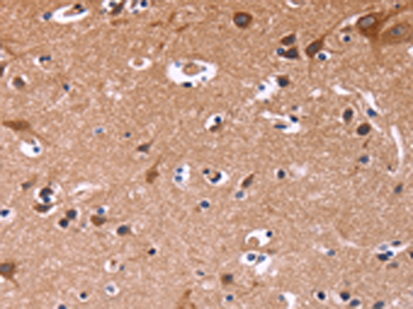 Rabbit Polyclonal Antibody to SIGLEC5