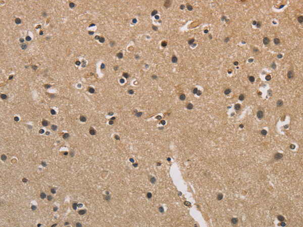 Rabbit Polyclonal Antibody to CENPN