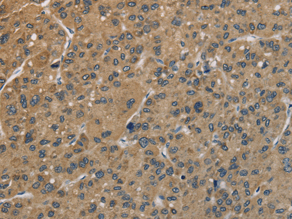 Rabbit Polyclonal Antibody to CENPN