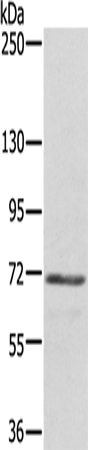 DTNB
