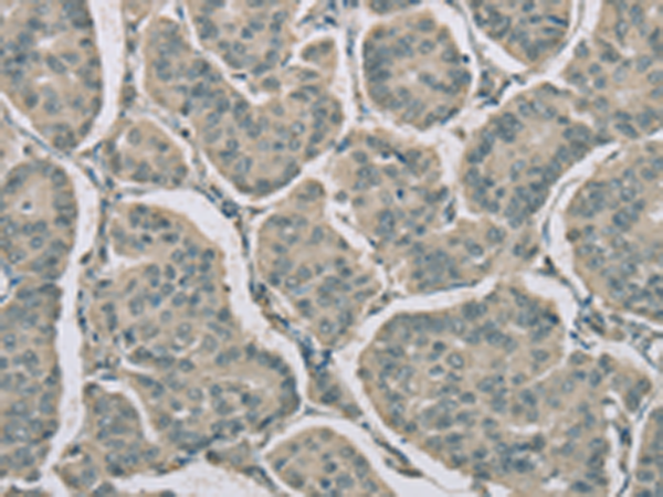 Rabbit Polyclonal Antibody to RNASE3
