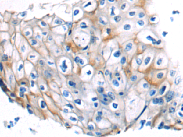 Rabbit Polyclonal Antibody to LETMD1