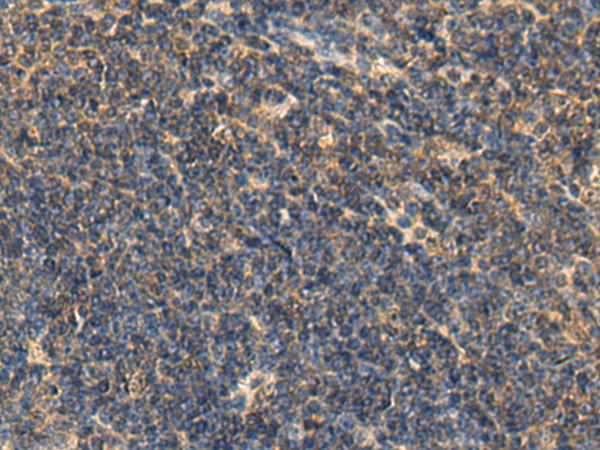 Rabbit Polyclonal Antibody to LIPC