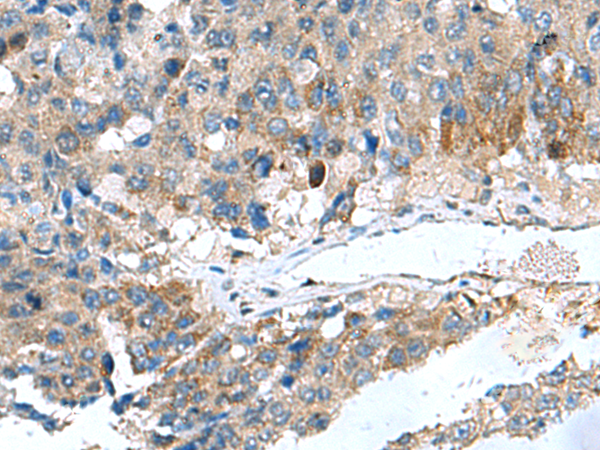 Rabbit Polyclonal Antibody to HSD11B1