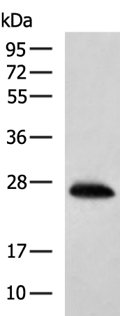 HSD17B14