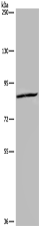 KIF2A
