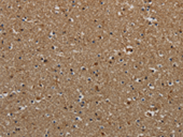 Rabbit Polyclonal Antibody to KLK6