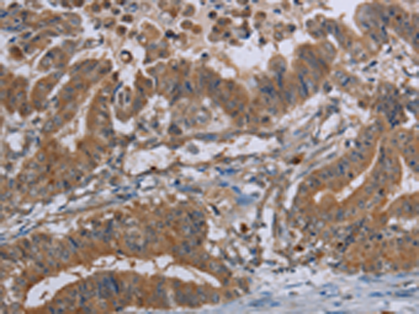 Rabbit Polyclonal Antibody to LCMT1