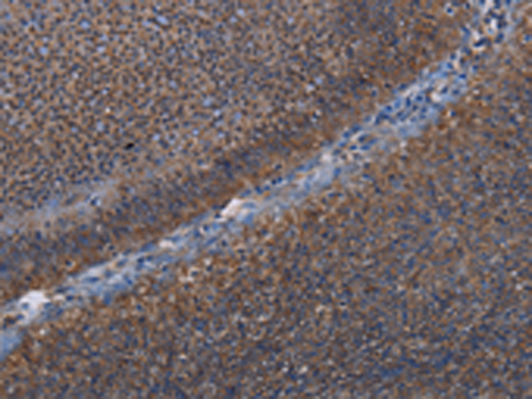 Rabbit Polyclonal Antibody to P3H3